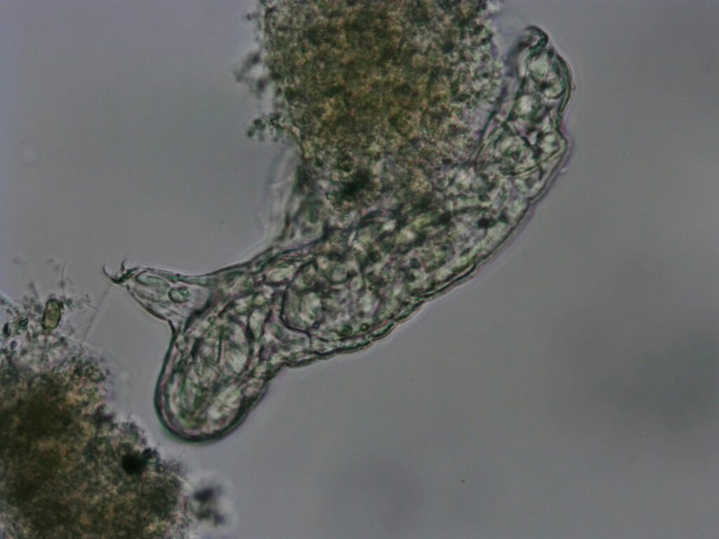 Microscope image of a microorganism in wastewater sludge.  