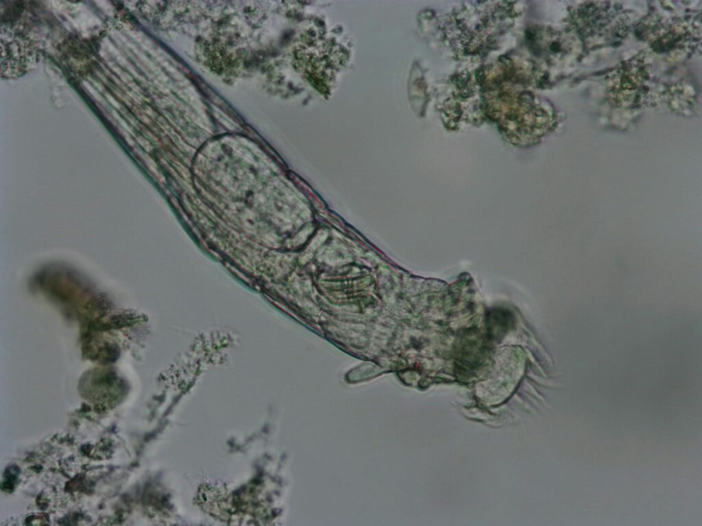 Microscope image of a microorganism in wastewater sludge.
