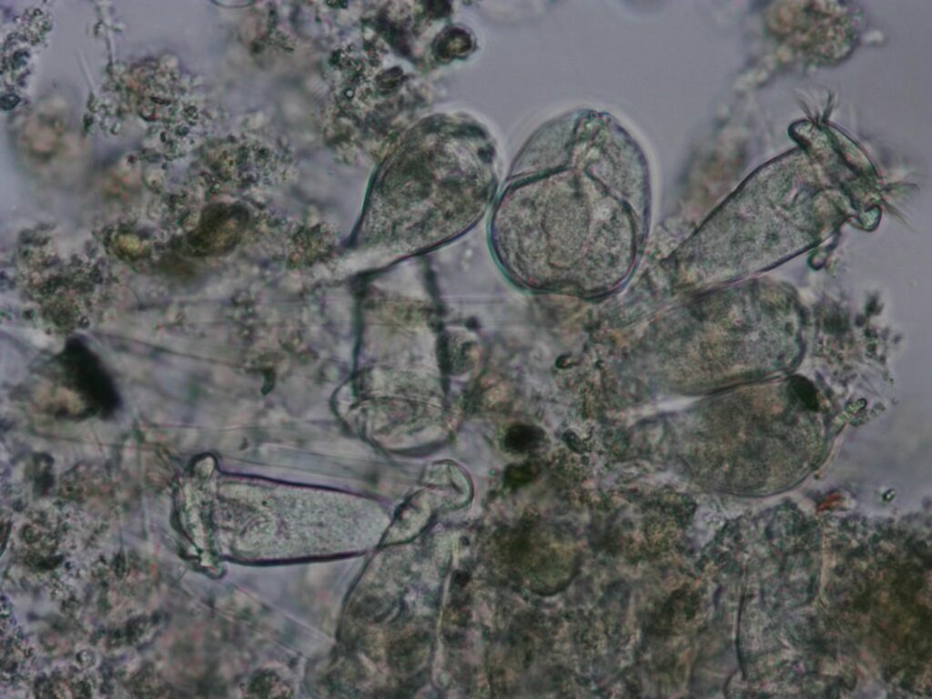 Microscope image of multiple microorganisms in wastewater sludge.  