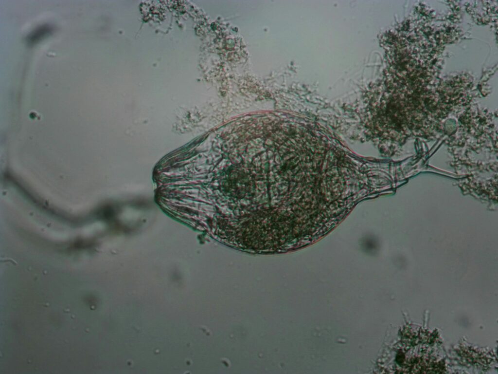 Microscope image of a microorganism in wastewater sludge.
